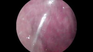 Camera deep inside of the wet pussy and captured the intense female orgasm!!