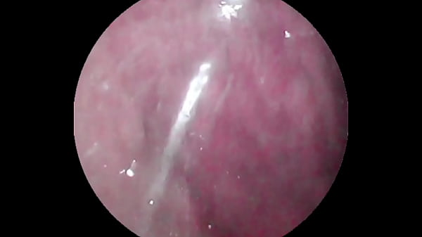 camera deep inside of the wet pussy and captured the intense female orgasm